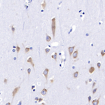 BID Recombinant Rabbit mAb (S-R300)