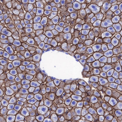 p120 Catenin Recombinant Rabbit mAb (SDT-350-75)
