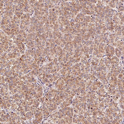 SFXN1/TCC Rabbit Polyclonal Antibody