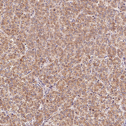 SFXN1/TCC Rabbit Polyclonal Antibody