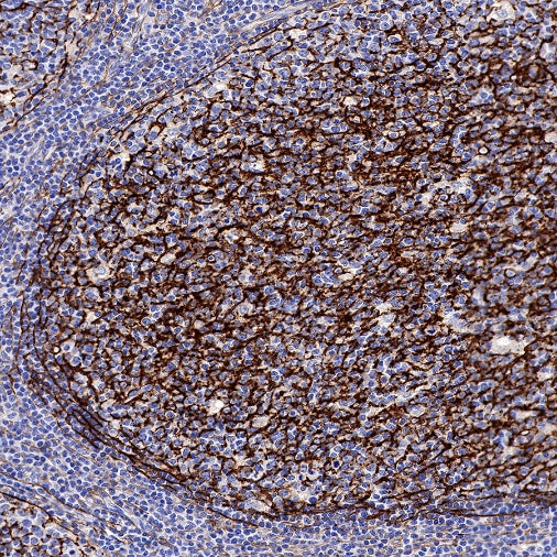 TMEM119 Recombinant Rabbit mAb (S-1040-14)