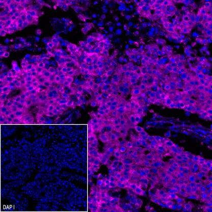 PABP Recombinant Rabbit mAb (S-1744-42)
