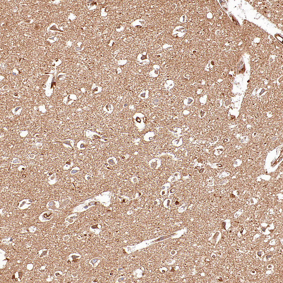 KLC1 Recombinant Rabbit mAb (S-4556-8)