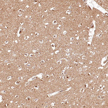 KLC1 Recombinant Rabbit mAb (S-4556-8)
