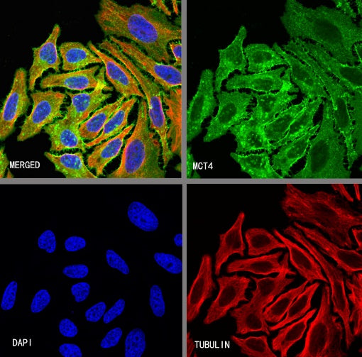 S-RMab® MCT4 Recombinant Rabbit mAb (S-1437-7)