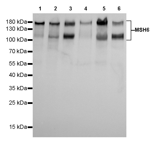 S-RMab® MSH6 Recombinant Rabbit mAb,PBS Only (SDT-R094)