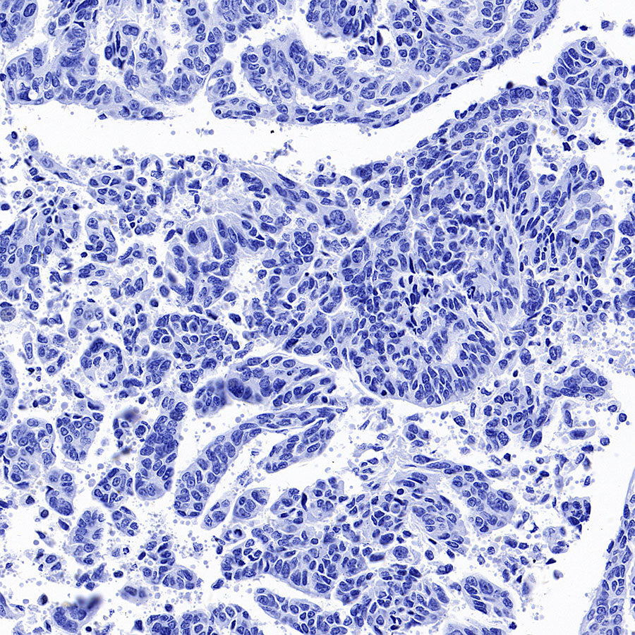 Inhibin alpha Recombinant Rabbit mAb (SDT-3212-24)