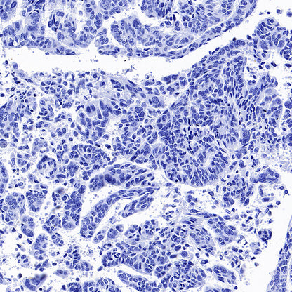 Inhibin alpha Recombinant Rabbit mAb (SDT-3212-24)