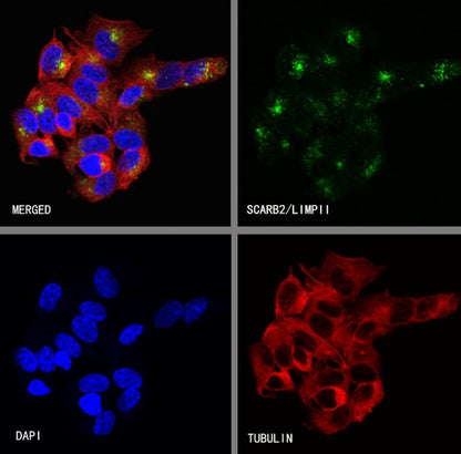 SCARB2/LIMPII Recombinant Rabbit mAb (S-2847-21)