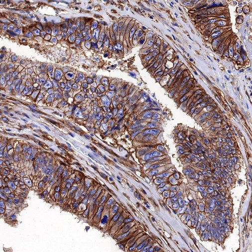 S-RMab® MCT4 Recombinant Rabbit mAb (S-1437-7)