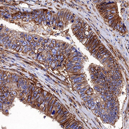 S-RMab® MCT4 Recombinant Rabbit mAb (S-1437-7)