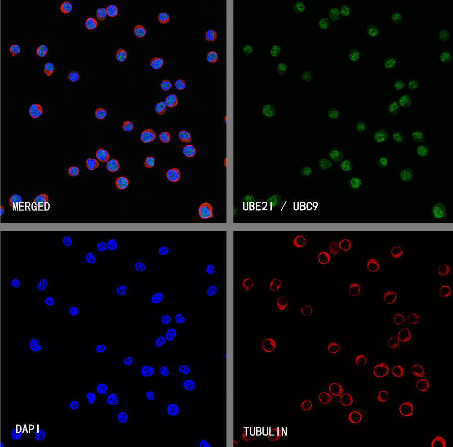 UBE2I / UBC9 Rabbit Polyclonal Antibody
