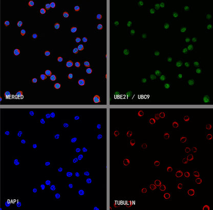 UBE2I / UBC9 Rabbit Polyclonal Antibody