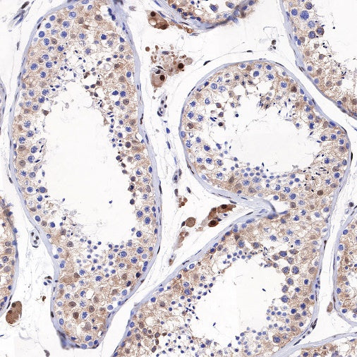 SQSTM1/p62 Recombinant Rabbit mAb (S-778-1)
