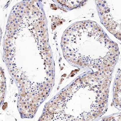 SQSTM1/p62 Recombinant Rabbit mAb (S-778-1)
