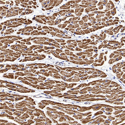 VDAC1 Recombinant Rabbit mAb (S-1877-18)