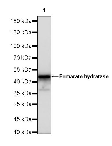 Fumarate hydratase Recombinant Rabbit mAb, PBS Only (SDT-2434-54)