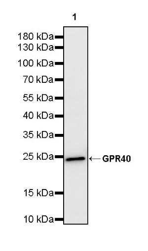 GPR40 Recombinant Rabbit mAb (S-3817-50)