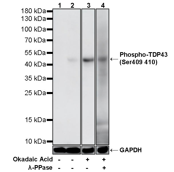 Phospho-TDP43 (Ser409/410) Recombinant Rabbit mAb (S-3862)