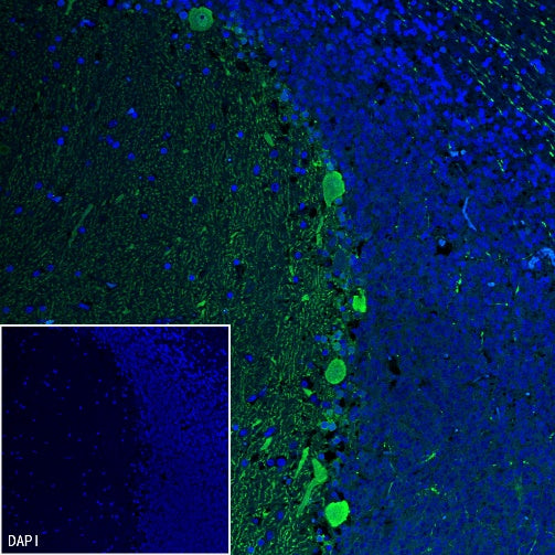 Calbindin Recombinant Rabbit mAb (S-774-378)