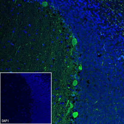 Calbindin Recombinant Rabbit mAb (S-774-378)
