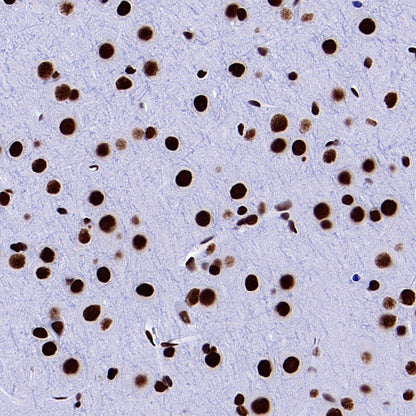 hnRNP H Rabbit Polyclonal Antibody