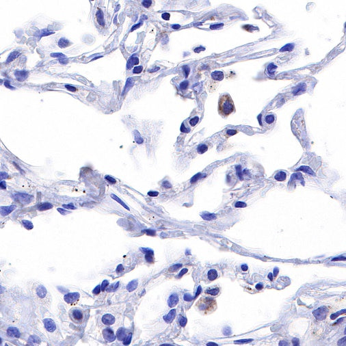 PTP1B Recombinant Rabbit mAb (S-R336)