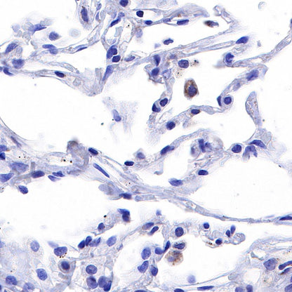 PTP1B Recombinant Rabbit mAb (S-R336)
