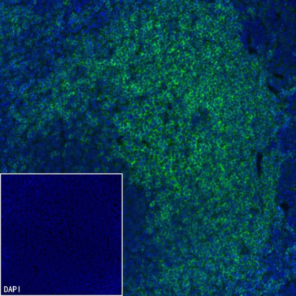 CD20 Recombinant Rabbit mAb (Alexa Fluor® 488 Conjugate) (S-R133)