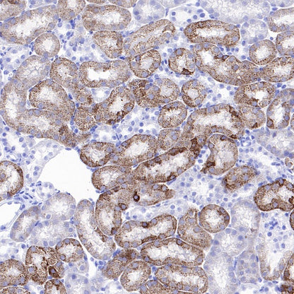 SLC25A51 Recombinant Rabbit mAb (S-2070-74)