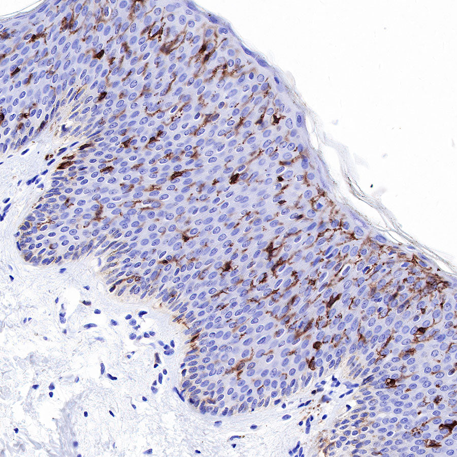 CD1A Recombinant Rabbit mAb (SDT-R086)