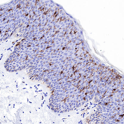 CD1A Recombinant Rabbit mAb (SDT-R086)