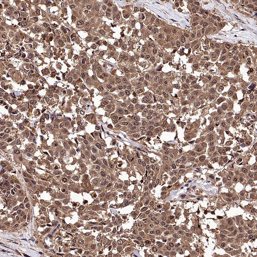 LMPTP Rabbit Polyclonal Antibody