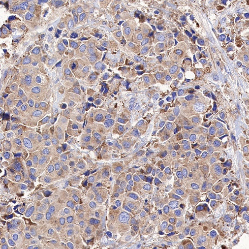 Calreticulin Recombinant Rabbit mAb (S-R353)