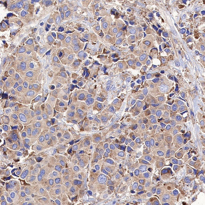 Calreticulin Recombinant Rabbit mAb (S-R353)