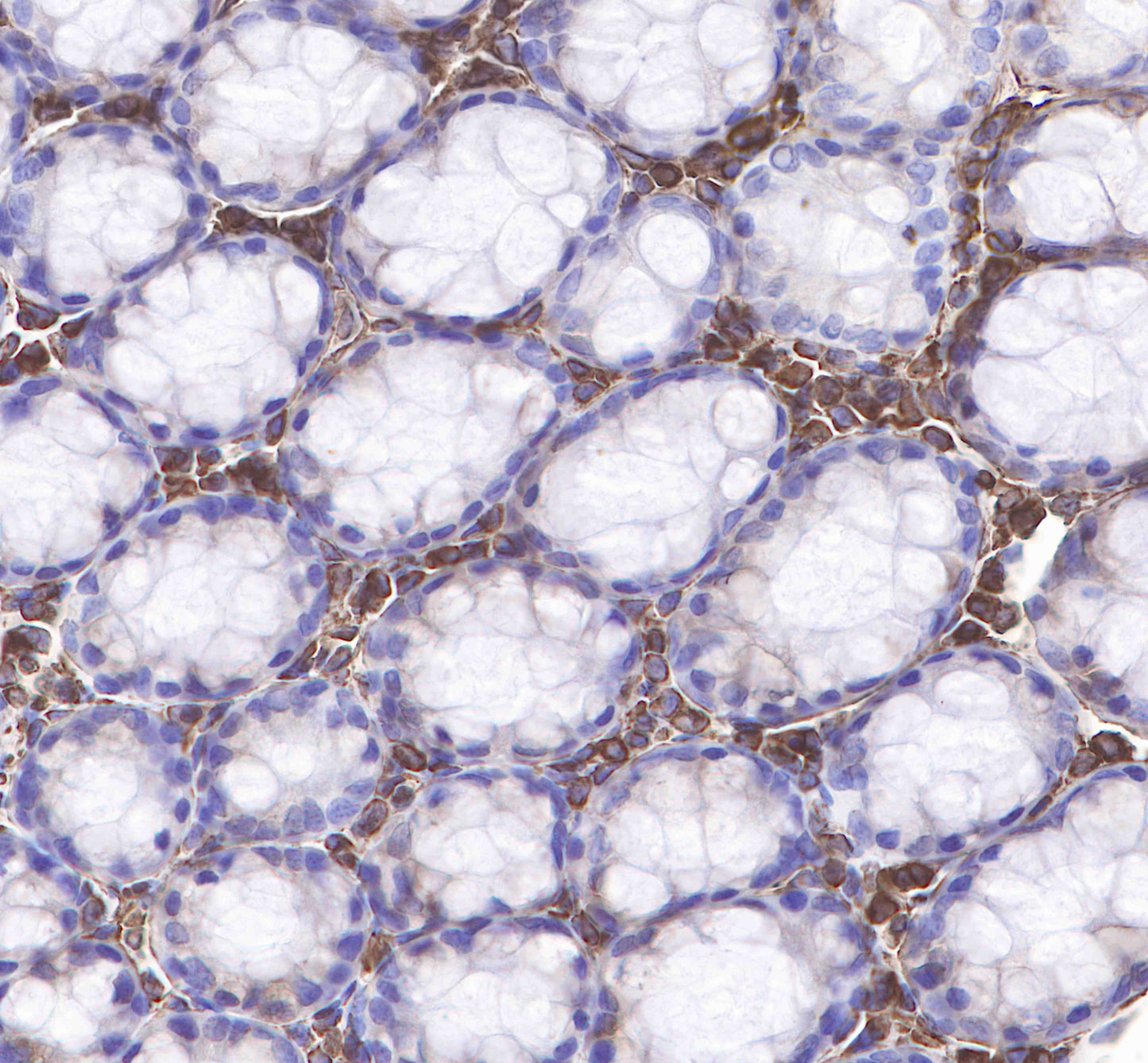Vimentin Recombinant Rabbit mAb,PBS Only (SDT-029-20)