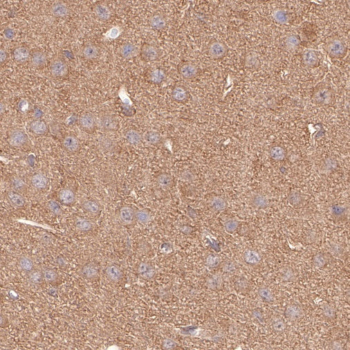 PKM Recombinant Rabbit mAb (S-812-20)