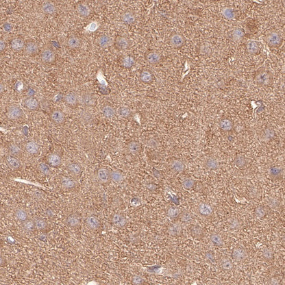 PKM Recombinant Rabbit mAb (S-812-20)