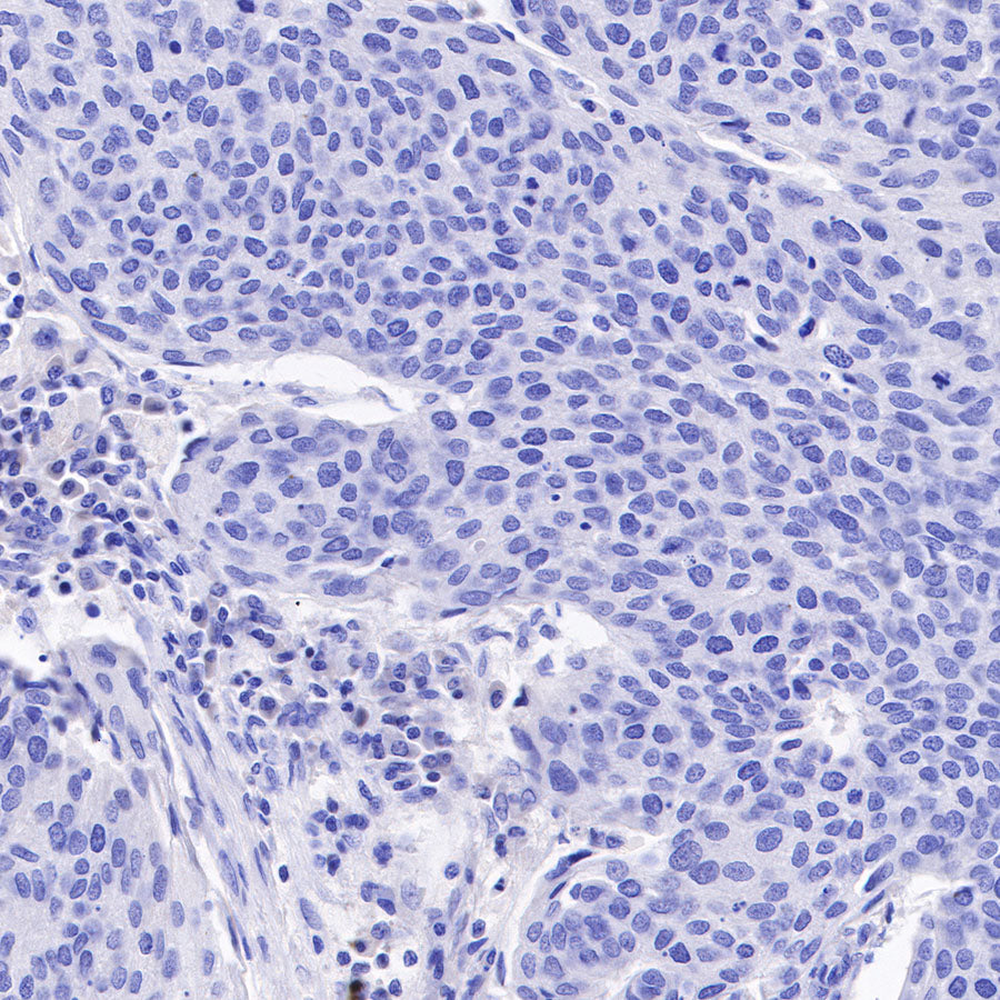 Androgen Receptor Recombinant Rabbit mAb (SDT-R167)