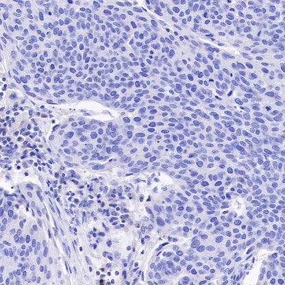 Androgen Receptor Recombinant Rabbit mAb (SDT-R167)