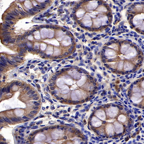 PDCD6 Recombinant Rabbit mAb (S-578-98)