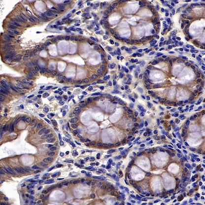 PDCD6 Recombinant Rabbit mAb (S-578-98)