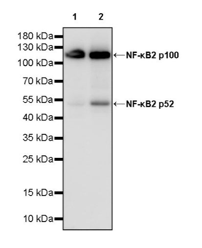 NF-κB2 p100/p52 Recombinant Rabbit mAb (S-2502-208)