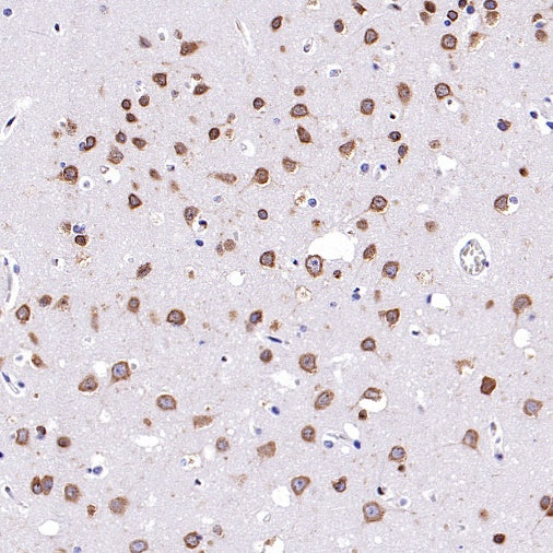 Argonaute 2 Recombinant Rabbit mAb (S-2620-13)