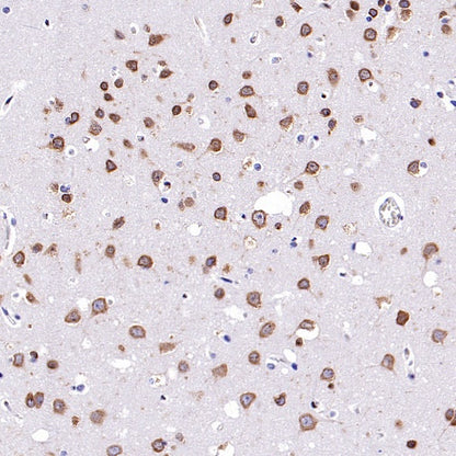 Argonaute 2 Recombinant Rabbit mAb (S-2620-13)