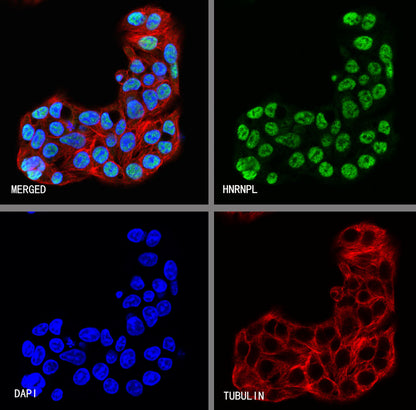 HNRNPL Rabbit Polyclonal Antibody