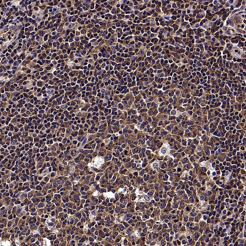 NF-κB p105/p50 Recombinant Rabbit mAb (S-3354)