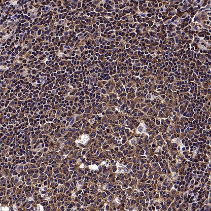 NF-κB p105/p50 Recombinant Rabbit mAb (S-3354)