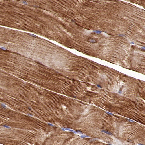 S-RMab® Desmin Recombinant Rabbit mAb (SDT-109-114)