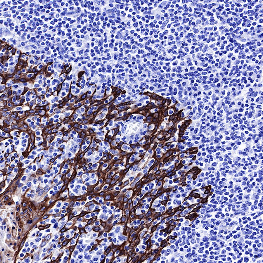 keratin 6 Rabbit mAb (SDT-015-69)